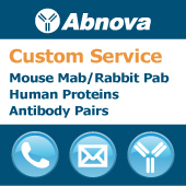 abnova-custom-services.jpg